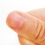 Spiritual Meanings of Right & Left Thumb Itching